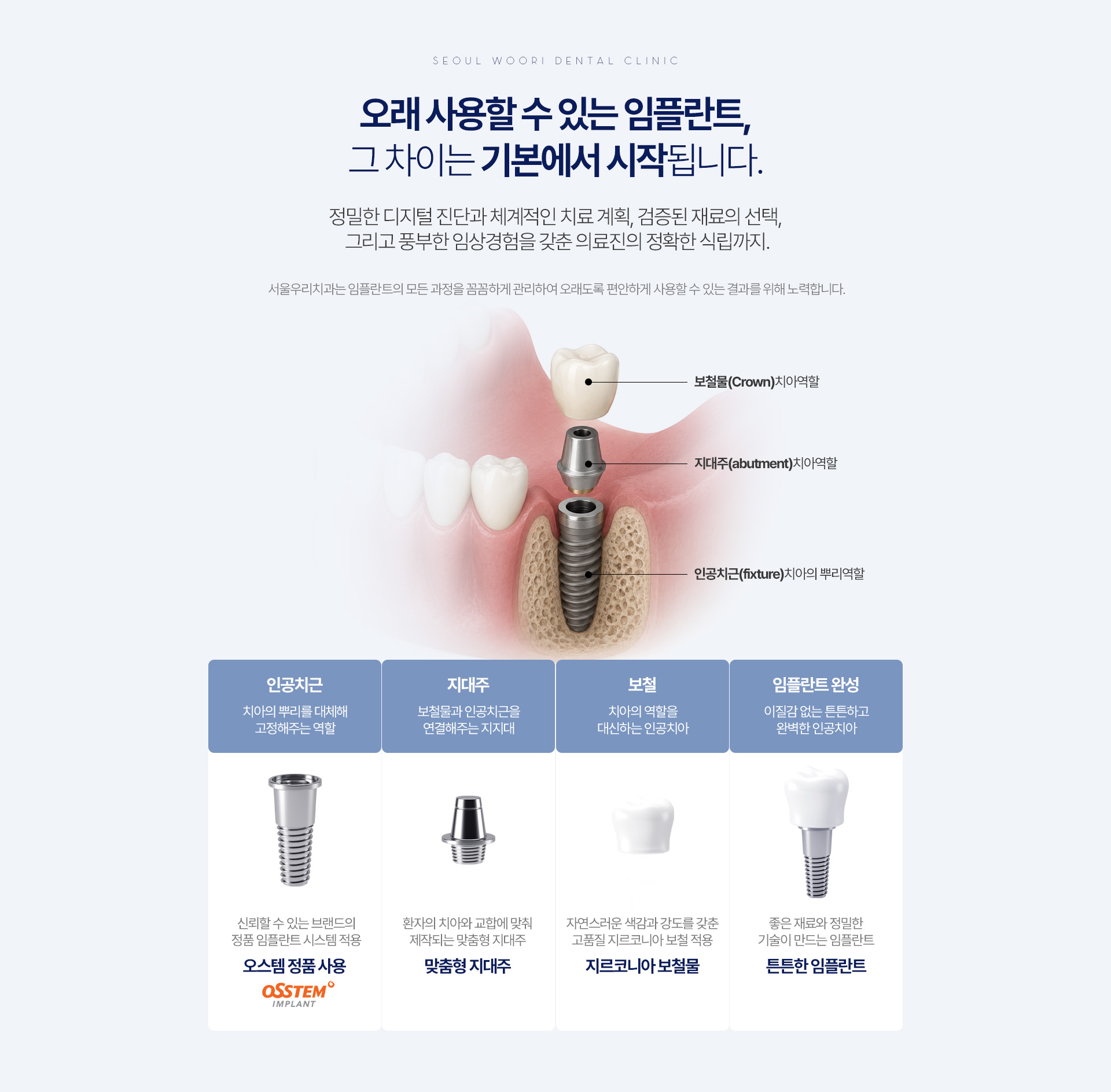 오래 사용할 수 있는 임플란트, 정밀 디지털 진단과 맞춤형 지대주·지르코니아 보철