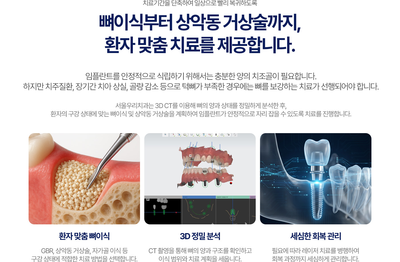 뼈이식부터 상악동 거상술까지 제공하는 환자 맞춤 임플란트 치료