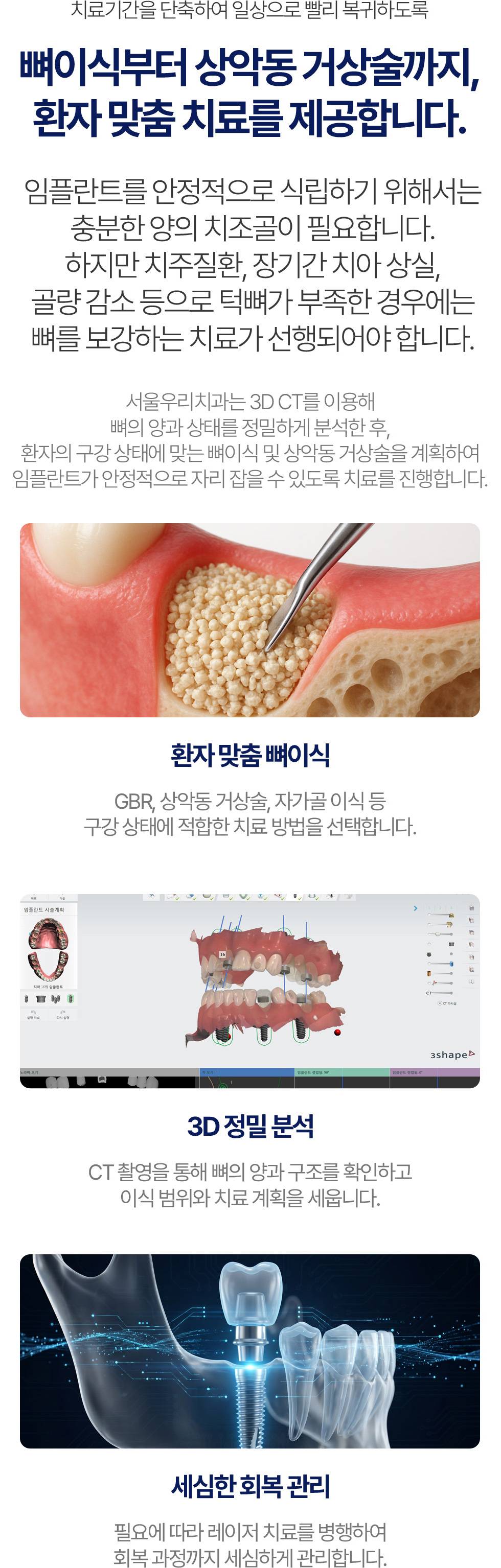 뼈이식부터 상악동 거상술까지 제공하는 환자 맞춤 임플란트 치료