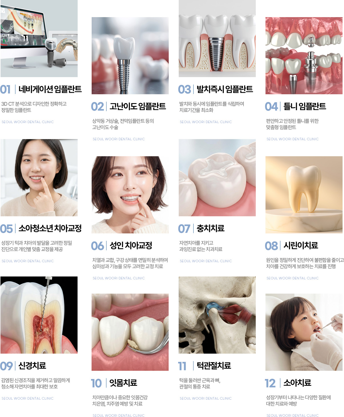 서울우리치과 진료과목, 네비게이션 임플란트부터 소아치료까지 12개 진료
